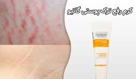 کرم کلاژن ساز پوست شکم گاتیو ایتالیا 100 میل