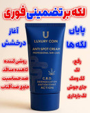 وایتکس جهانی صورت کرم فرانسوی رفع لک لاکچری کوین تضمینی اصل از بین برنده لکه های تیره و مقاوم صورت و بدن حاوی spf ضد افتاب _ 50 میل