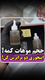 تونیک تخصصی اکسونیک توقف و ضد ریزش مو _ پرپشت کردن مو و محرک رشد مو وتغذیه ساقه و پیاز مو به همراه اپلیکاتور - کاملاا اصل تضمینی